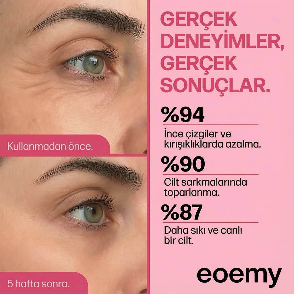 Eoemy-Yüz Toparlayıcı Gençlik Maskesi