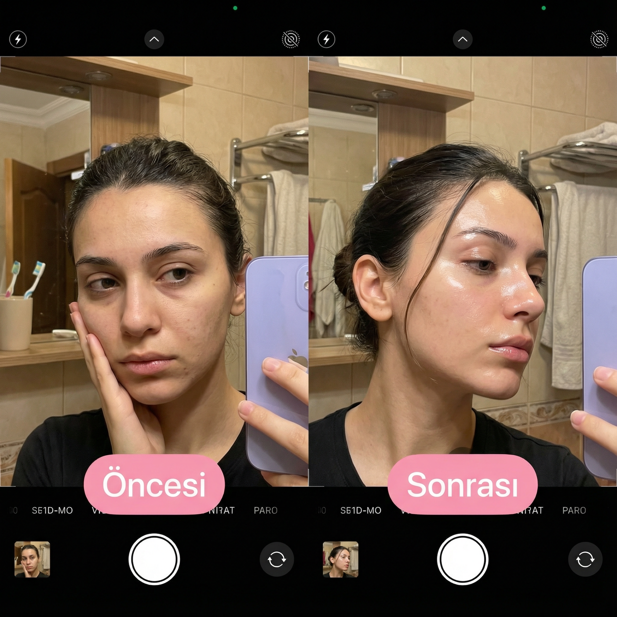 Eoemy-Yüz Toparlayıcı Gençlik Maskesi